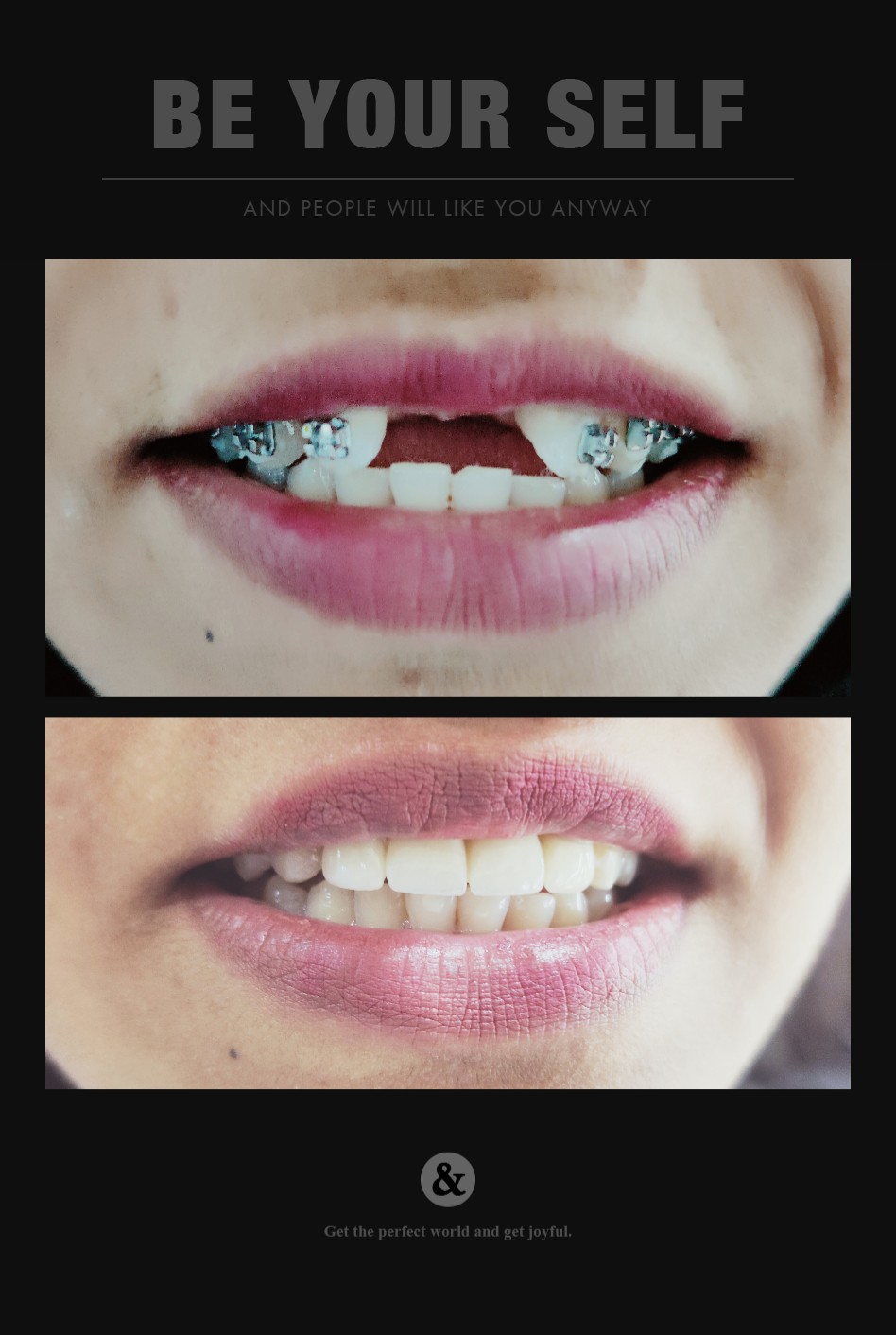 Before after braces treatment Dental Studio